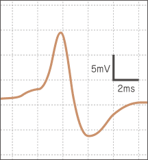 体の中の活動電位の波形の図